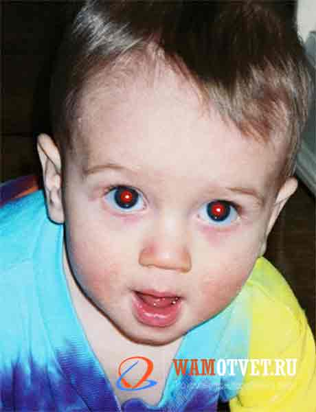 Фотографии детей с красными глазами