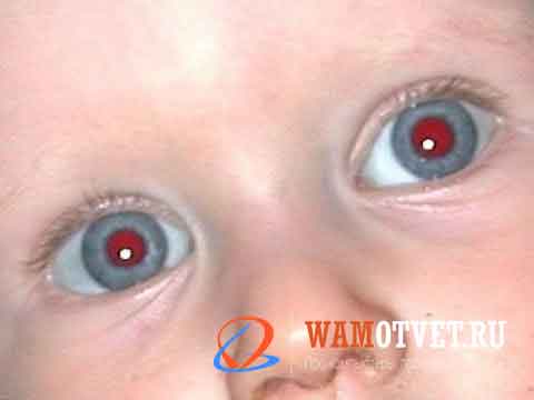 Красные глаза от вспышки у ребенка